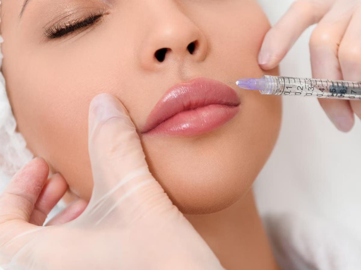 Entdecken Sie professionelle Lippen Aufspritzen Nürnberg und Hautstraffung bei MY AESTHETICS