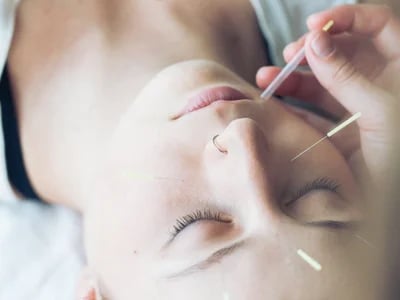 Miért válassza az akupunkturát? – Akupunkturbehandlungen usw indoklása