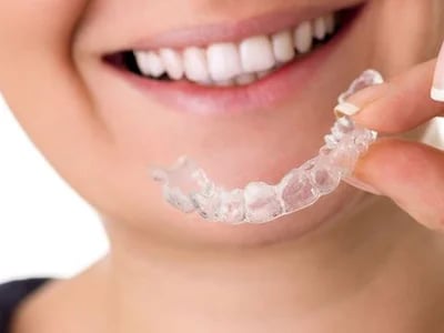 Invisalign Behandlung: Die Revolution in der Zahnstellungskorrektur für ein strahlendes Lächeln
