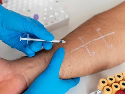 Allergietest Wien – Privat und Professionell in Ihrer HNO-Praxis