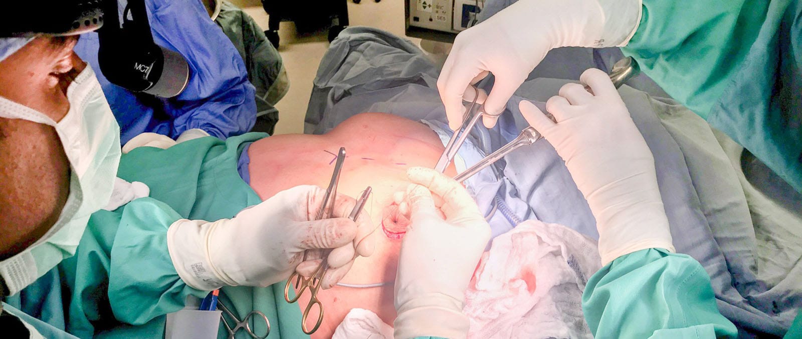 Ästhetik Centrum Bochum: Ihr führendes Zentrum für Brustchirurgie in Nordrhein-Westfalen