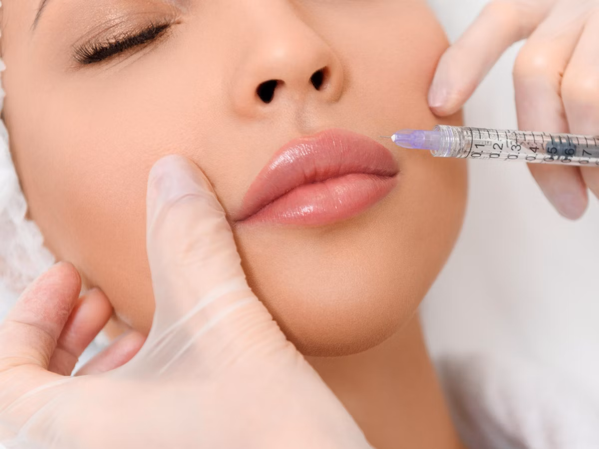Entdecken Sie professionelle Lippen Aufspritzen Nürnberg und Hautstraffung bei MY AESTHETICS