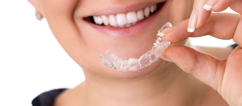 Invisalign Behandlung: Die Revolution in der Zahnstellungskorrektur für ein strahlendes Lächeln