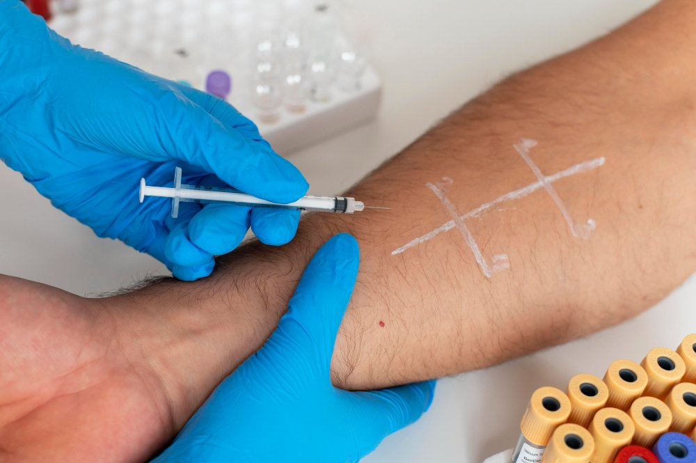 Allergietest Wien – Privat und Professionell in Ihrer HNO-Praxis