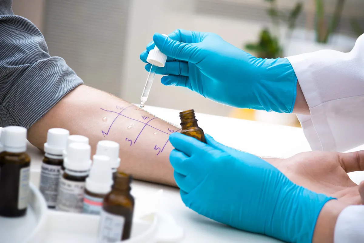 Allergietest Wien – Privat und Professionell in Ihrer HNO-Praxis